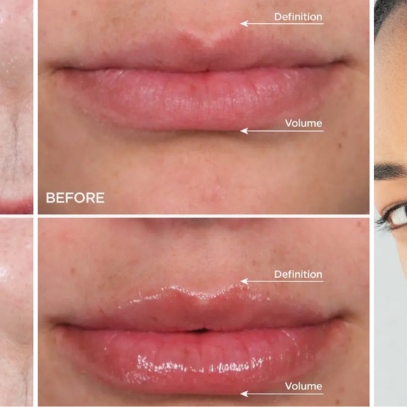 BeautyBio 5-Star Faves Skincare Set NIB - Picture 3 of 4